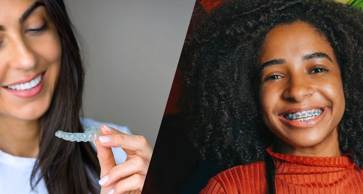 Invisalign® vs. Braces: Which Treatment Is Best For You?